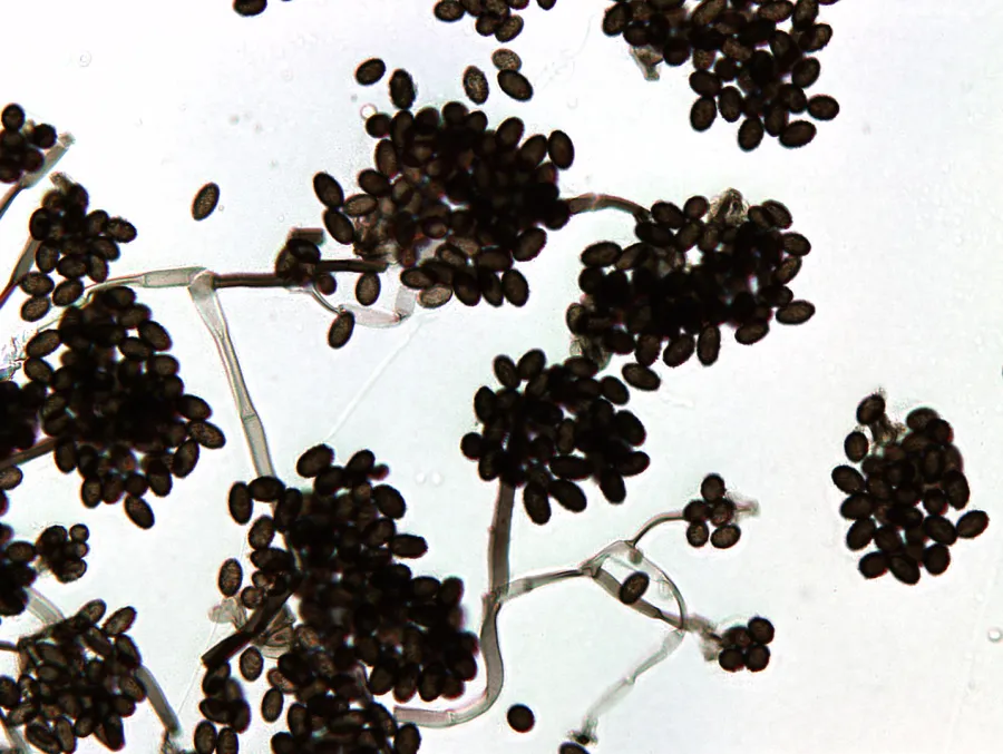 Esempi al microscopio di spore di Muffa Nera